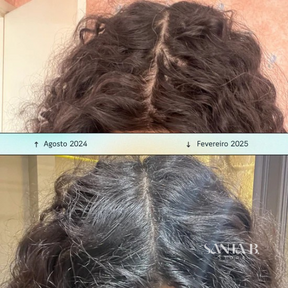 Massageador Capilar Elétrico para Couro Cabeludo - Revita Hair